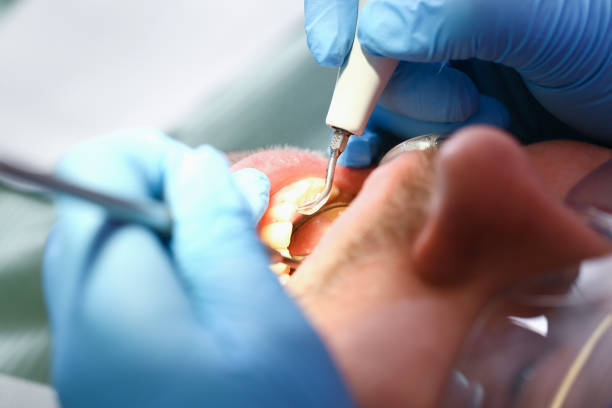Best Emergency Gum Treatment in Mesa Del Caballo, AZ